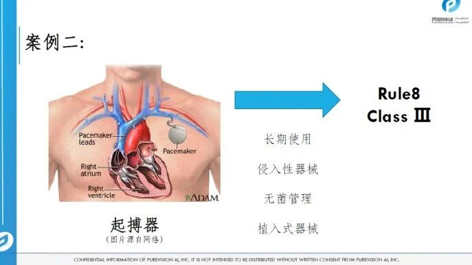 文章配图:胡心洁:医疗器械注册转化之监管之路(上)