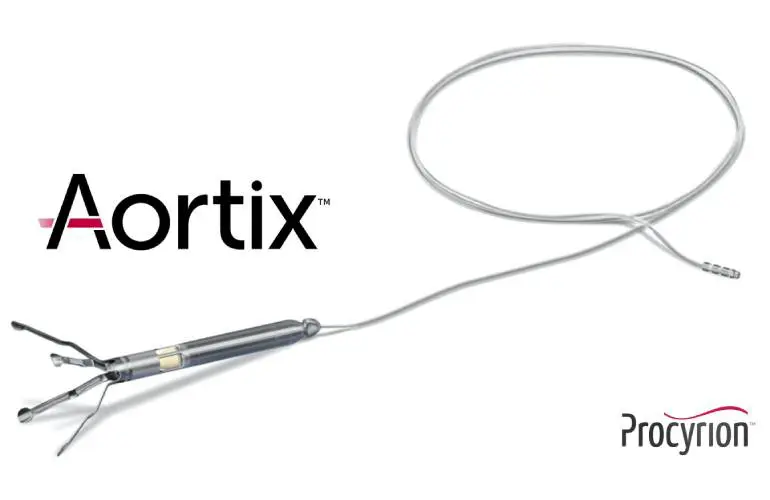 Procyrion Aortix循环支持装置产生积极的研究结果