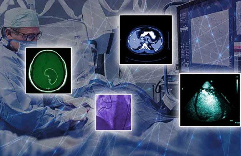 GE Healthcare加速器挑选AI成像初创企业