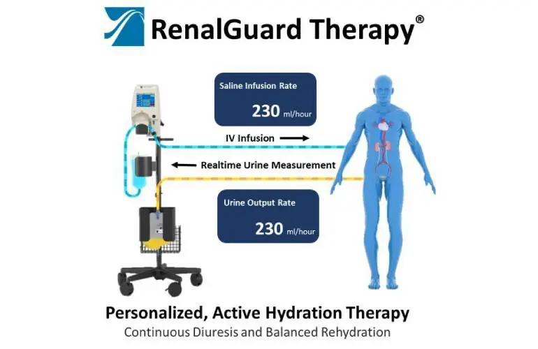 CardioRenal Systems RenalGuard治疗装置获FDA突破性认可