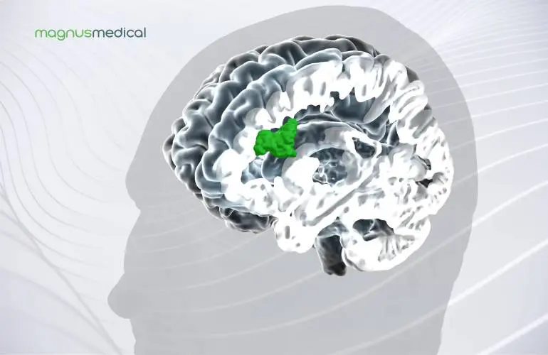 FDA批准Magnus Medical治疗抑郁症的神经调节系统