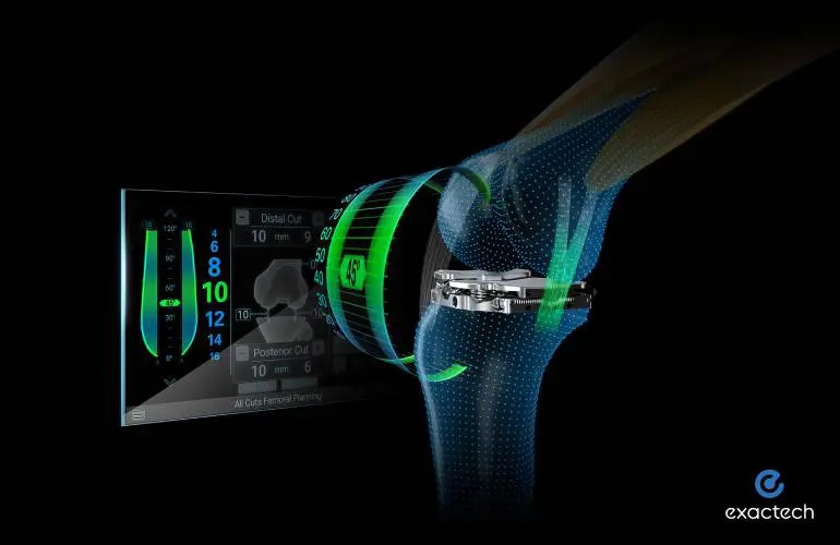 Exactech宣布使用新工具在Newton膝关节技术中进行了首次手术