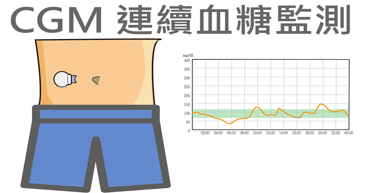 文章配图:普瑞研究院 | CGMs 连续血糖监测系统技术要求!