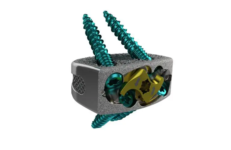 ChoiceSpine推出新的前路腰椎融合系统产品