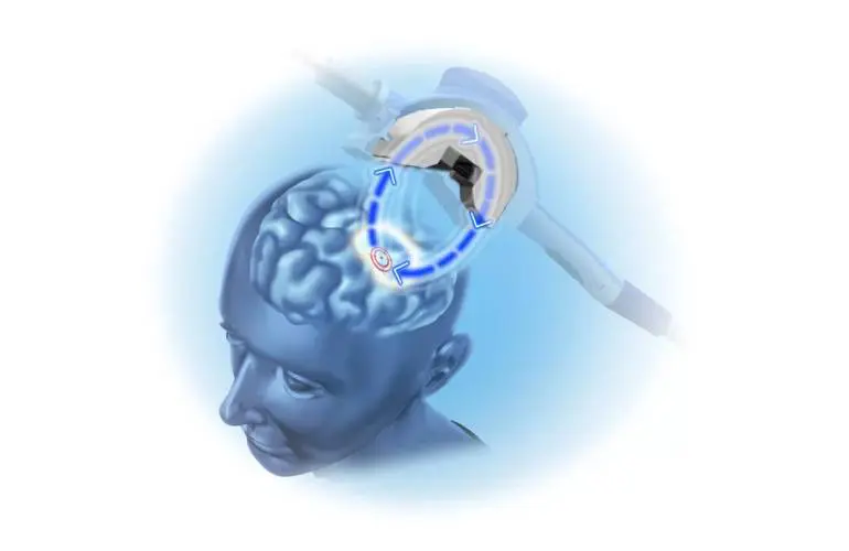 Aetna政策更新扩大使用Neuronetics NeuroStar的权限