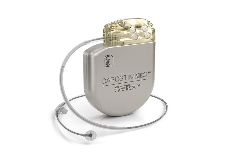 研究支持CVRx Barostim神经调节治疗心力衰竭患者